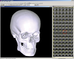 Skull in 3D