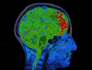 brain neuroimaging