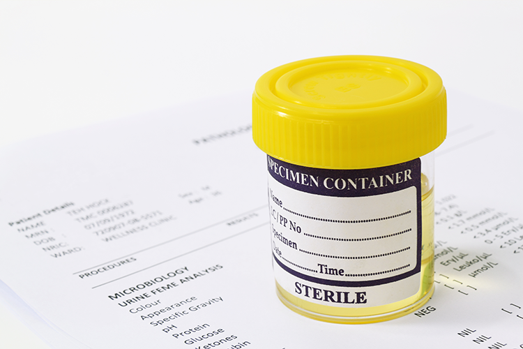 urine container for a drug test